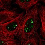 SRFBP1 Polyclonal Antibody