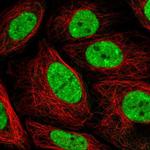 PLEKHG4B Polyclonal Antibody