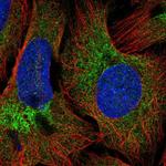 COPB2 Polyclonal Antibody