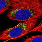 MTPAP Polyclonal Antibody