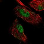 MIER3 Polyclonal Antibody