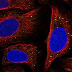 SLC14A1 Polyclonal Antibody