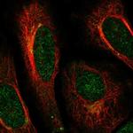 ACAP3 Polyclonal Antibody