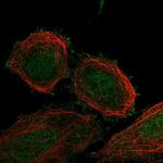 FBXO41 Polyclonal Antibody