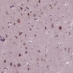 PORCN Polyclonal Antibody