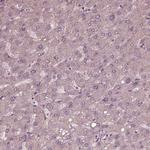 PORCN Antibody in Immunohistochemistry (Paraffin) (IHC (P))