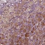 PORCN Antibody in Immunohistochemistry (IHC)