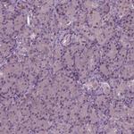 PORCN Antibody in Immunohistochemistry (IHC)