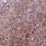 PORCN Antibody in Immunohistochemistry (IHC)