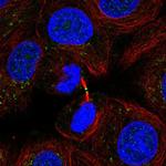 ADAMTS19 Polyclonal Antibody