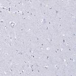 UAP56 Antibody in Immunohistochemistry (Paraffin) (IHC (P))