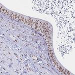 UAP56 Antibody in Immunohistochemistry (IHC)