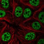 UAP56 Polyclonal Antibody