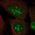 DUX4 Polyclonal Antibody