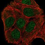 ZNF541 Polyclonal Antibody