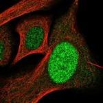 SP110 Polyclonal Antibody