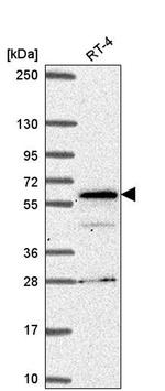 SP110 Antibody in Western Blot (WB)