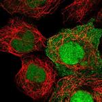 HEATR3 Polyclonal Antibody