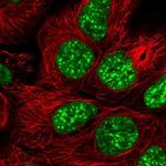 SRRM1 Antibody in Immunocytochemistry (ICC/IF)