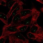 eIF4E3 Antibody in Immunocytochemistry (ICC/IF)