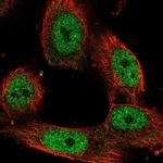 STAG1 Antibody in Immunocytochemistry (ICC/IF)