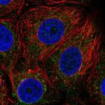 BDH1 Polyclonal Antibody