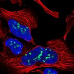 GPALPP1 Polyclonal Antibody