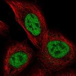 TSSC4 Polyclonal Antibody