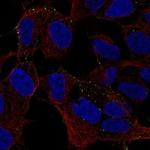 MYO16 Polyclonal Antibody