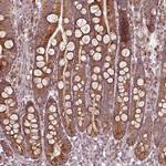 SEL1L3 Antibody in Immunohistochemistry (IHC)