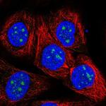 RP11-849H4.2 Antibody in Immunocytochemistry (ICC/IF)