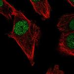 POLM Polyclonal Antibody