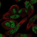 FAM101A Polyclonal Antibody