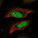 CENPP Polyclonal Antibody