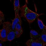 SLC9B1 Polyclonal Antibody