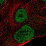 OVCA2 Polyclonal Antibody