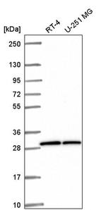 OVCA2 Antibody in Western Blot (WB)