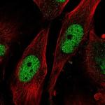 SAP30 Polyclonal Antibody