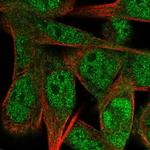 CREST Polyclonal Antibody