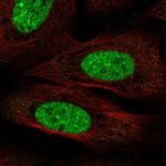 CPEB3 Polyclonal Antibody