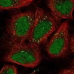 EXOC6 Polyclonal Antibody