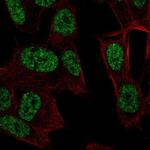 RALYL Polyclonal Antibody