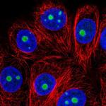 SNRNP35 Polyclonal Antibody