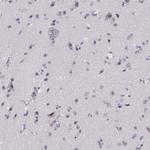 KRTAP2-4 Antibody in Immunohistochemistry (Paraffin) (IHC (P))