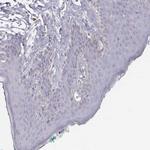 KRTAP2-4 Antibody in Immunohistochemistry (Paraffin) (IHC (P))