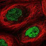 N6AMT1 Polyclonal Antibody