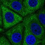 EYA2 Polyclonal Antibody