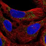 M1AP Antibody in Immunocytochemistry (ICC/IF)
