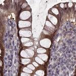 GSS Antibody in Immunohistochemistry (IHC)