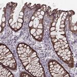 GSS Antibody in Immunohistochemistry (IHC)